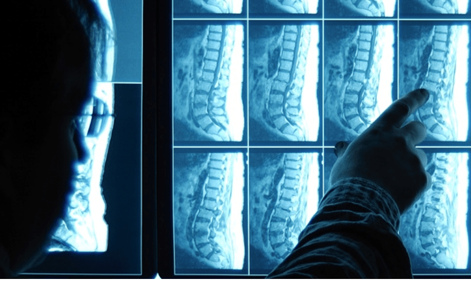 Each year over two million Spanish patients will receive safer radiographic 1